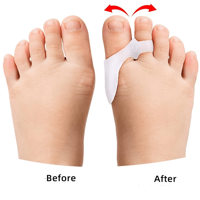 1/2/3 ペア子供用ジェルつま先セパレーター外反母趾コレク - Toe Separator Silicon のレビューと価格