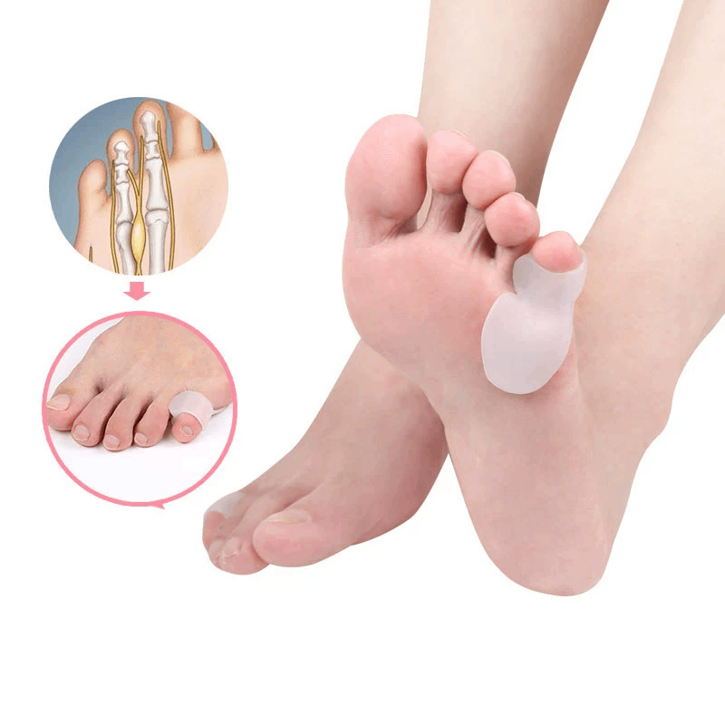 1/2/5ペアの小指プロテクター、外反母趾矯正具、外反母趾の - Toe Separator Silicon のレビューと価格