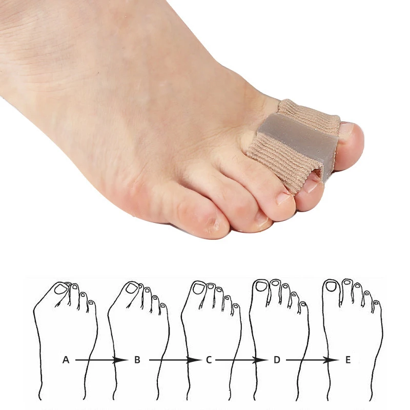 新しい足指セパレーター外反母趾矯正装具ナイトフットケア親指デ - Toe Separator Silicon のレビューと価格